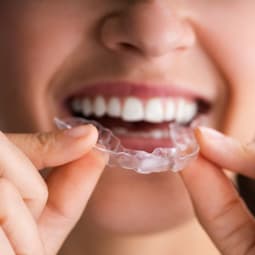 Invisalign: Die unsichtbare Lösung für Zahnkorrekturen