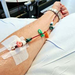 Kanüle im männlichen Arm bereit für die intravenöse Infusion