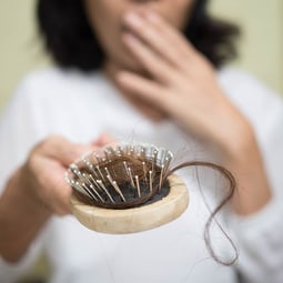 Erblich bedingter Haarausfall