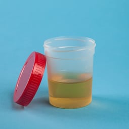Urinprobe