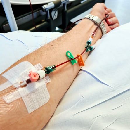 Kanüle im männlichen Arm bereit für die intravenöse Infusion