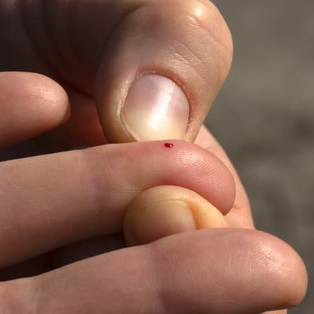 Ein Tropfen Blut am Finger.